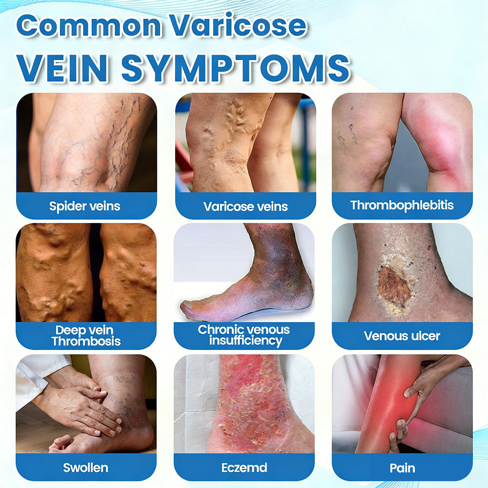 🇺🇸🏆𝗚𝗙𝗢𝗨𝗞® VascuCare Vein Healing Spray(Designed for Varicose veins, Spider veins, Deep vein Thrombosis, Chronic venous insufficiency, Venous ulcers, Thrombophlebitis and other venous issues)