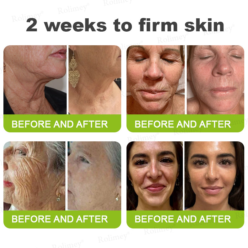 🇺🇸Made and shipped from the USA 💥Rolimey® Botox & Vita-A Retinol Shot Wrinkle-Lift Tightening cream - Last Day Promotion 70% OFF (Copy)