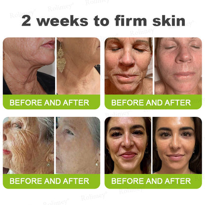 🇺🇸Made and shipped from the USA 💥Rolimey® Botox & Vita-A Retinol Shot Wrinkle-Lift Tightening cream - Last Day Promotion 70% OFF (Copy)