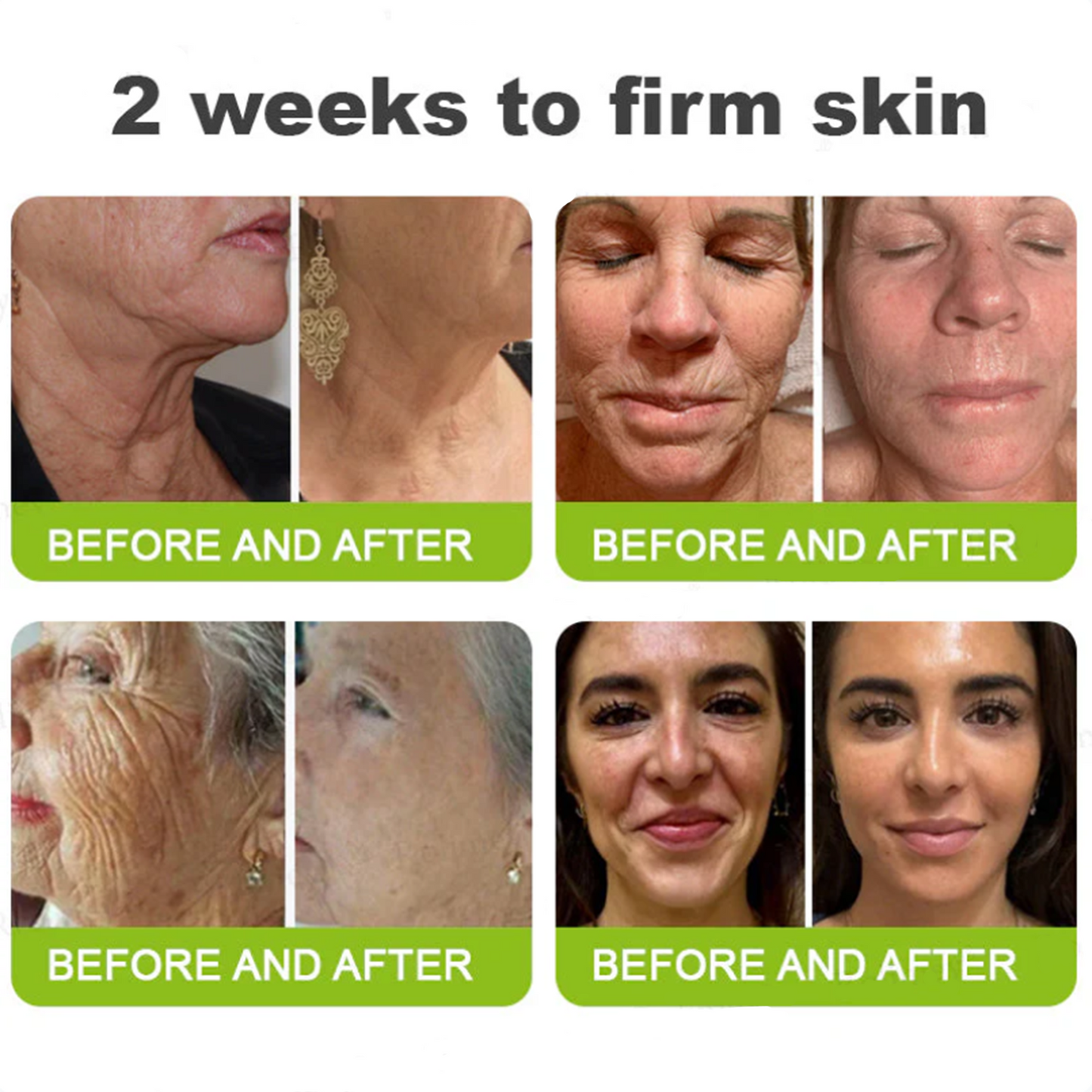 ✅Dr. Fachmer®👩‍⚕️ Peptide Collagen INSTANT TIGHTENING + PEPTIDE FIRMING CARE, Instantly smooths puffiness and lines while supporting firmer skin with continued use