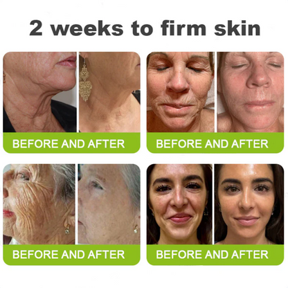 ✅Dr. Fachmer®👩‍⚕️ Peptide Collagen INSTANT TIGHTENING + PEPTIDE FIRMING CARE, Instantly smooths puffiness and lines while supporting firmer skin with continued use