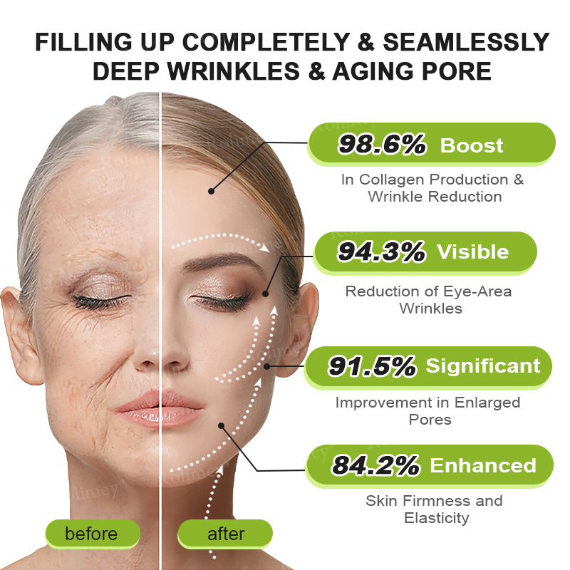 🇺🇸Made and shipped from the USA 💥Rolimey® Botox & Vita-A Retinol Shot Wrinkle-Lift Tightening cream - Last Day Promotion 70% OFF (Copy)