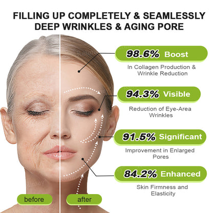 🇺🇸Made and shipped from the USA 💥Rolimey® Botox & Vita-A Retinol Shot Wrinkle-Lift Tightening cream - Last Day Promotion 70% OFF (Copy)