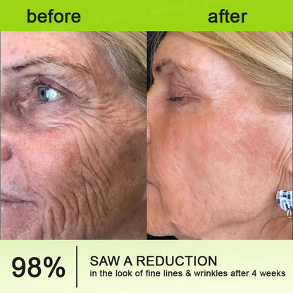 🇺🇸Made and shipped from the USA 💥Rolimey® Botox & Vita-A Retinol Shot Wrinkle-Lift Tightening cream - Last Day Promotion 70% OFF (Copy)