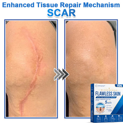 ✅ DR.Fachmer® 2-in-1 Microneedle & Hydrocolloid Patch | Raised Moles,Acne,  Flat Warts & Skin Tags Remover | Improves Wrinkles, Scars & Blemishes | Invisible Pimple Patches for Face & Body