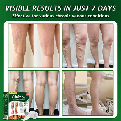 🌿DR.Fachmer® Vein Ease Microneedle Care Patch(For Spider Veins, Varicose Veins, Swelling & Leg Fatigue) - Last Day Promotion 50% OFF