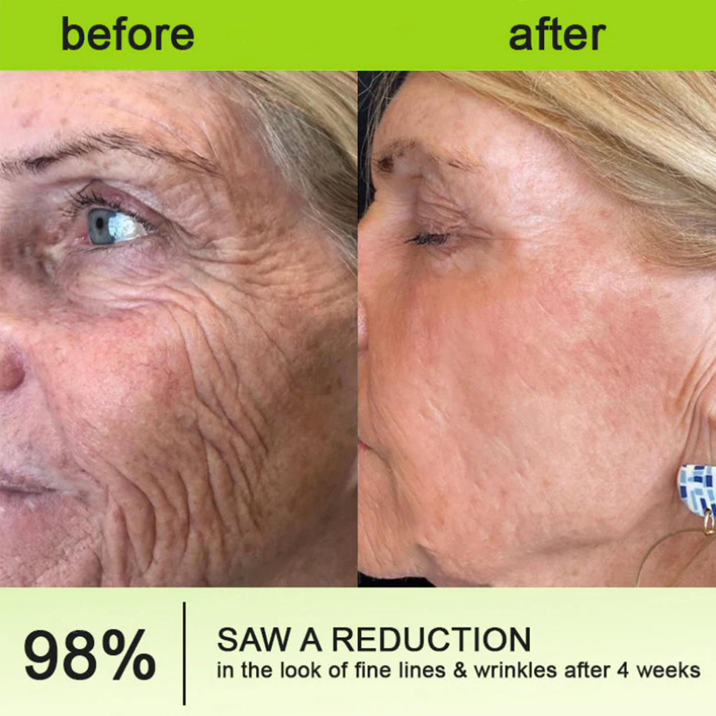 ✅Dr. Fachmer®👩‍⚕️ Peptide Collagen INSTANT TIGHTENING + PEPTIDE FIRMING CARE, Instantly smooths puffiness and lines while supporting firmer skin with continued use