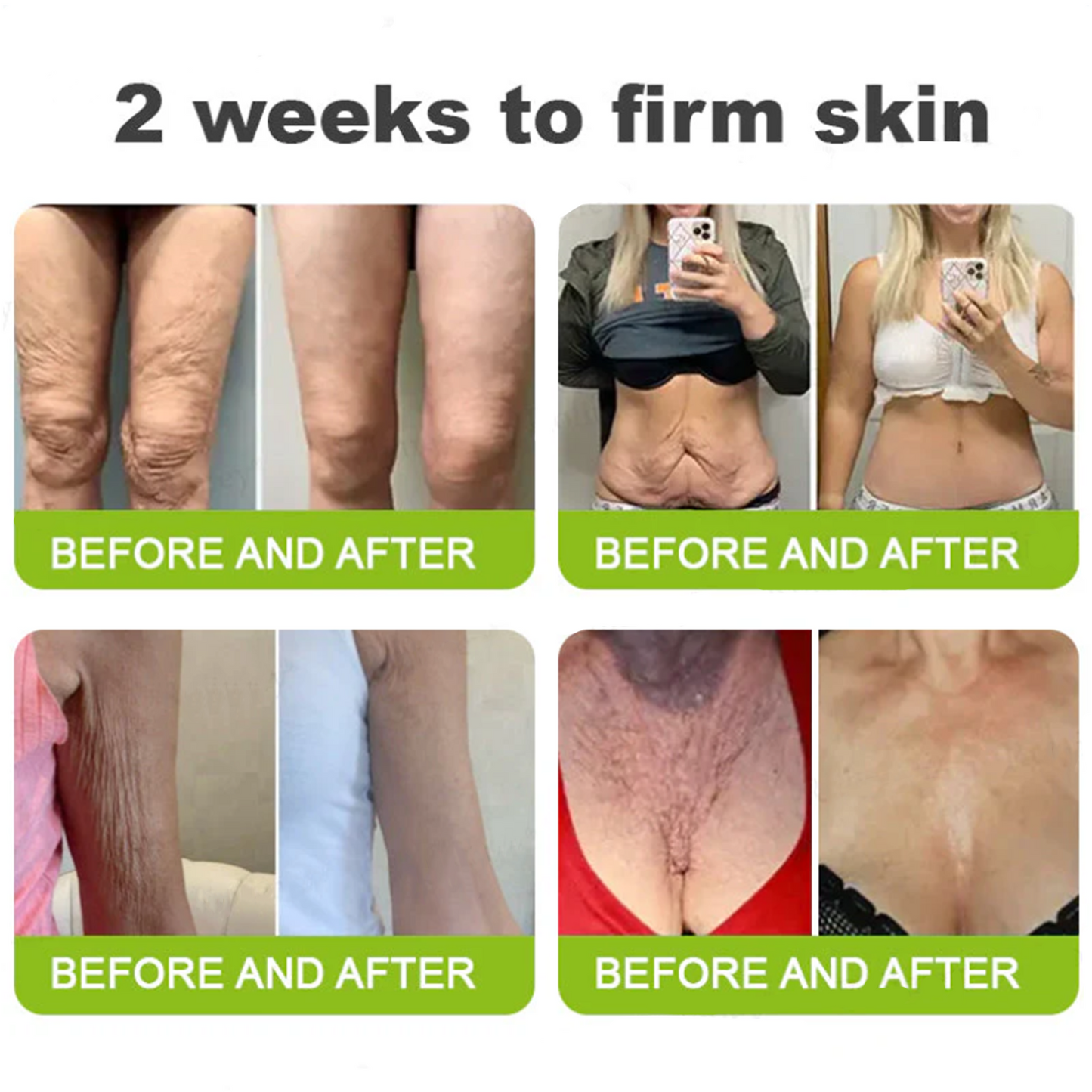 ✅Dr. Fachmer®👩‍⚕️ Peptide Collagen INSTANT TIGHTENING + PEPTIDE FIRMING CARE, Instantly smooths puffiness and lines while supporting firmer skin with continued use