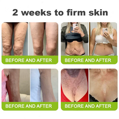 ✅Dr. Fachmer®👩‍⚕️ Peptide Collagen INSTANT TIGHTENING + PEPTIDE FIRMING CARE, Instantly smooths puffiness and lines while supporting firmer skin with continued use