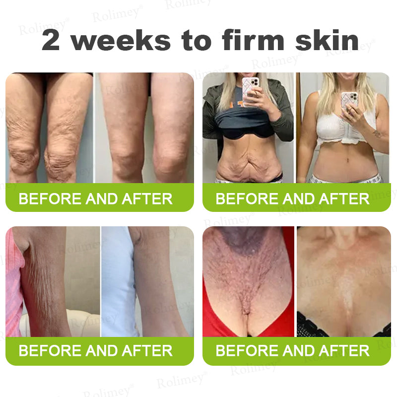 🇺🇸Made and shipped from the USA 💥Rolimey® Botox & Vita-A Retinol Shot Wrinkle-Lift Tightening cream - Last Day Promotion 70% OFF (Copy)