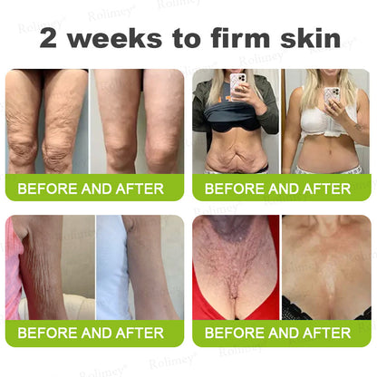 🇺🇸Made and shipped from the USA 💥Rolimey® Botox & Vita-A Retinol Shot Wrinkle-Lift Tightening cream - Last Day Promotion 70% OFF (Copy)