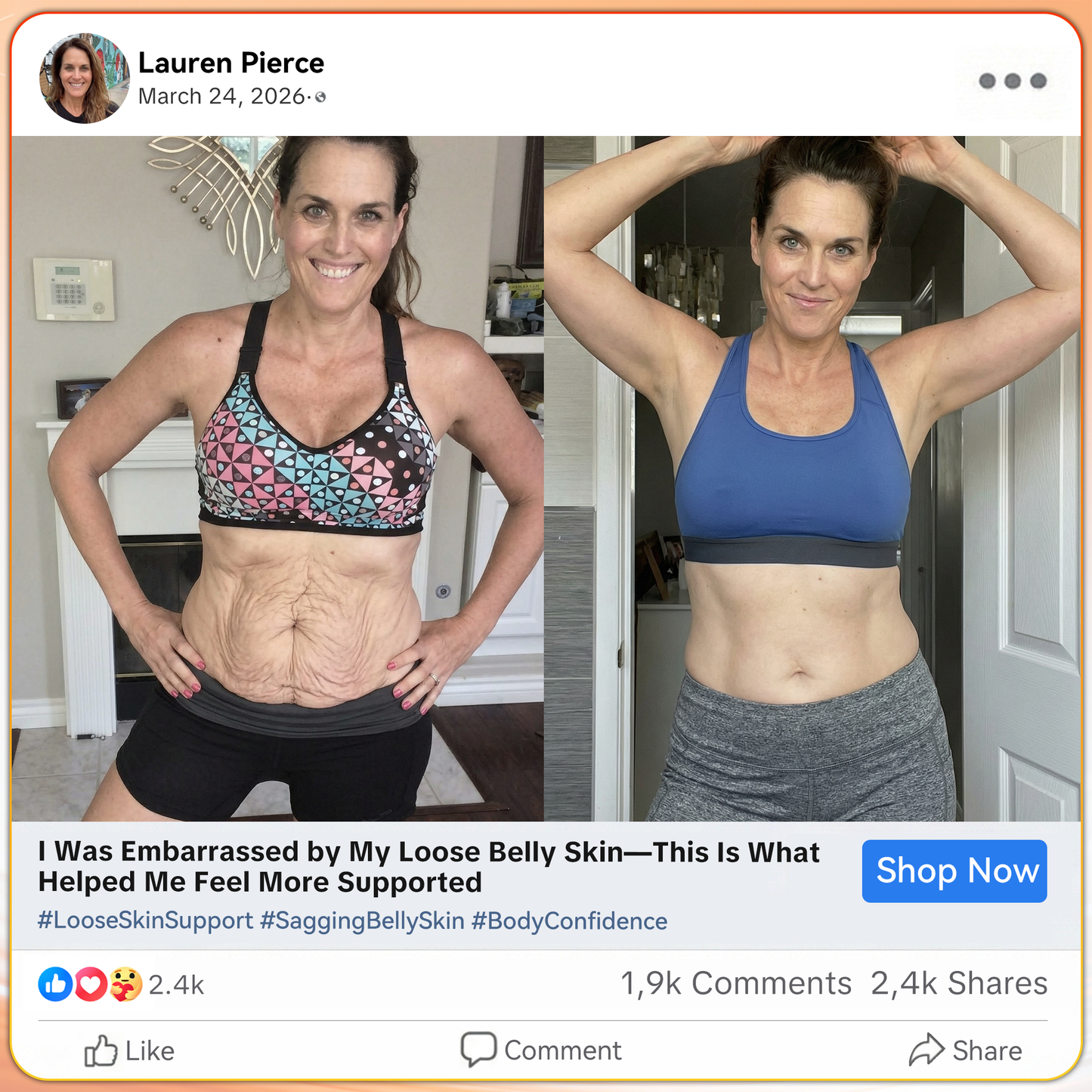 🇺🇲GFOUK® Moringa & Berberine 4-In-1 Micro-Particle Sculpting & Fat-Burn Shorts🌴