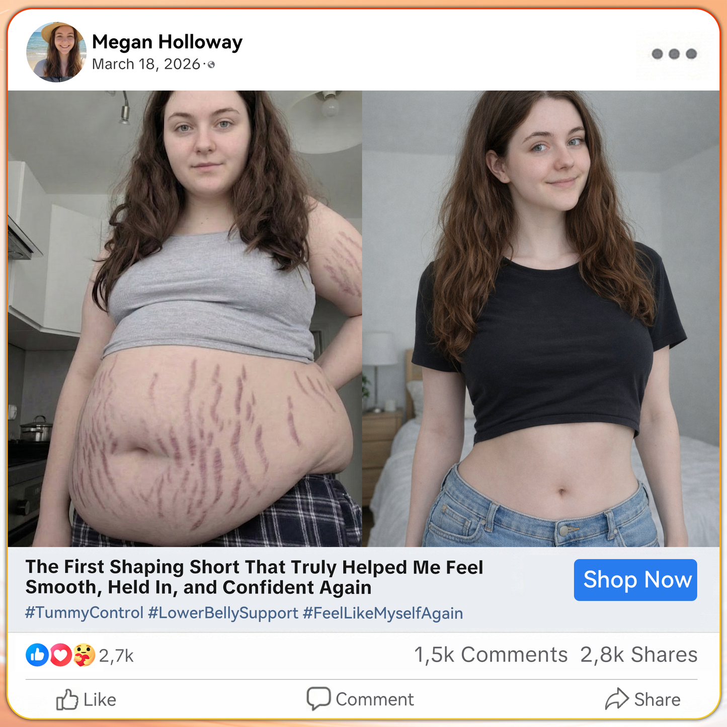 🇺🇲GFOUK® Moringa & Berberine 4-In-1 Micro-Particle Sculpting & Fat-Burn Shorts🌴