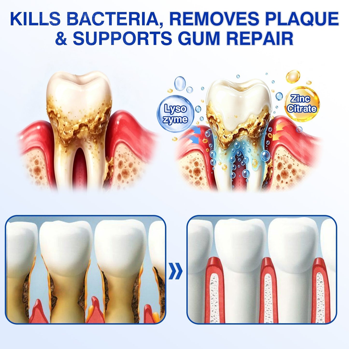🛡️🦷Evolvion® GumVital Advanced Gum Care Gel🛡️🎁