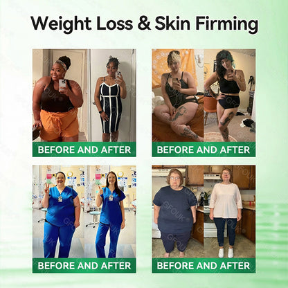 𝑶𝒇𝒇𝒊𝒄𝒊𝒂𝒍 𝑺𝒕𝒐𝒓𝒆  | 💛GFOUK®𝑴𝒐𝒓𝒊𝒏𝒈𝗮 · 𝗕𝗲𝗿𝗯𝗲𝗿𝙞𝙣𝙚 × 𝙉𝘼𝐃+ 𝟏𝟎-𝐢𝐧-𝟏 𝗔𝗱𝘃𝗮𝗻𝗰𝙚𝙙 𝙉𝙖𝙣𝙤 𝙈𝙞𝙘𝙧𝙤𝙣𝙚𝙚𝐝𝐥𝐞 𝐏𝐚𝐭𝙘𝙝🇺🇸(𝐉𝐮𝐬𝐭 𝐨𝐧𝐜𝐞 𝐚 𝐝𝐚𝐲, 𝐯𝐢𝐬𝐢𝐛𝐥𝐞 𝐜𝐡𝐚𝐧𝐠𝐞𝐬 𝐢𝐧 𝟕 𝐝𝐚𝐲𝐬） ✅ 𝐅𝐨𝐫 𝐨𝐛𝐞𝐬𝐢𝐭𝐲, 🅛🅞🅞🅢🅔 🅢🅚🅘🅝,𝐝𝐢𝐚𝐛𝐞𝐭𝐞𝐬, 𝐬𝐥𝐞𝐞𝐩 𝐚𝐩𝐧𝐞𝐚, 𝐣𝐨𝐢𝐧𝐭 𝐢𝐬𝐬𝐮𝐞𝐬, 𝐚𝐧𝐝 𝐦𝐨𝐫𝐞