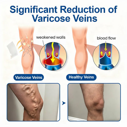 🇺🇸💥GFOUK® VeinEase Microneedle Care Patch⚡Instant Relief, Long-Term Results