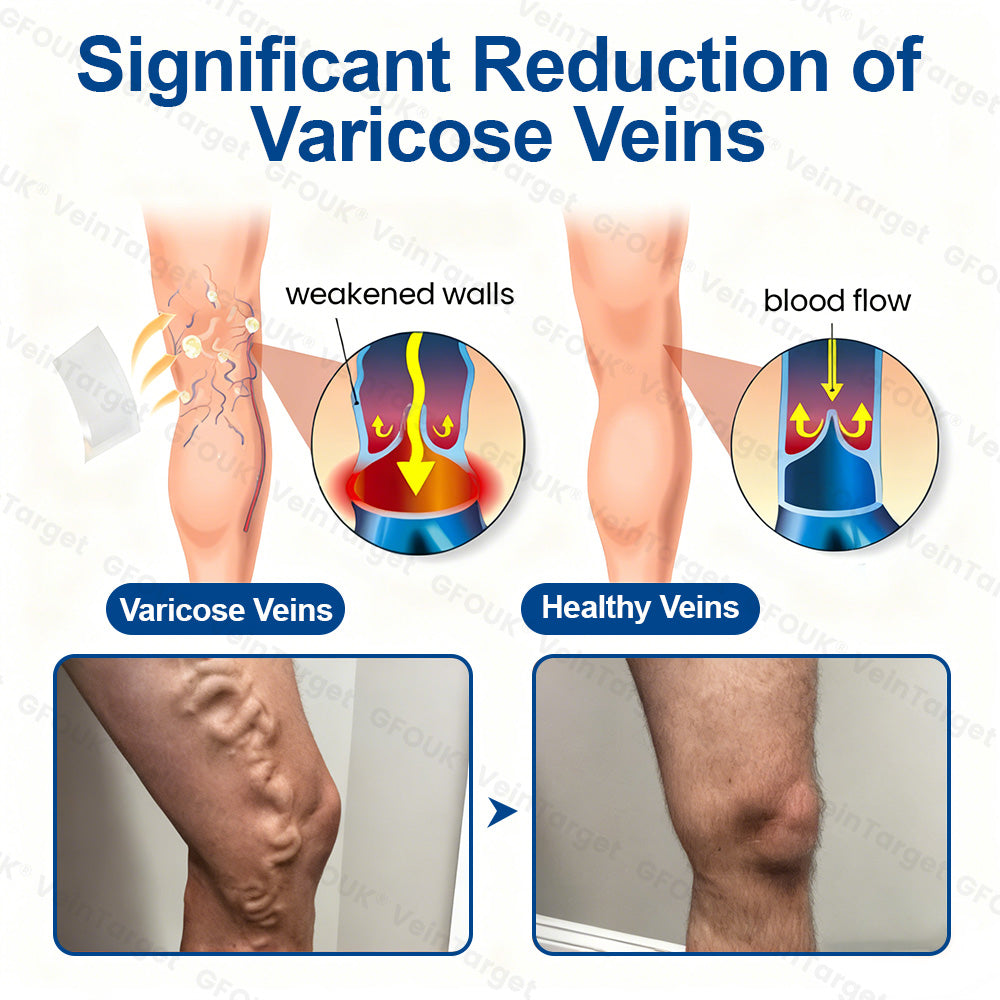 🇺🇸👨‍⚕️✅GFOUK® VeinTarget Microneedle Patch⚡Instant Relief, Long-Term Results