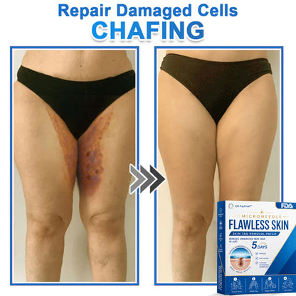 ✅ DR.Fachmer® 2-in-1 Microneedle & Hydrocolloid Patch | Raised Moles,Acne,  Flat Warts & Skin Tags Remover | Improves Wrinkles, Scars & Blemishes | Invisible Pimple Patches for Face & Body