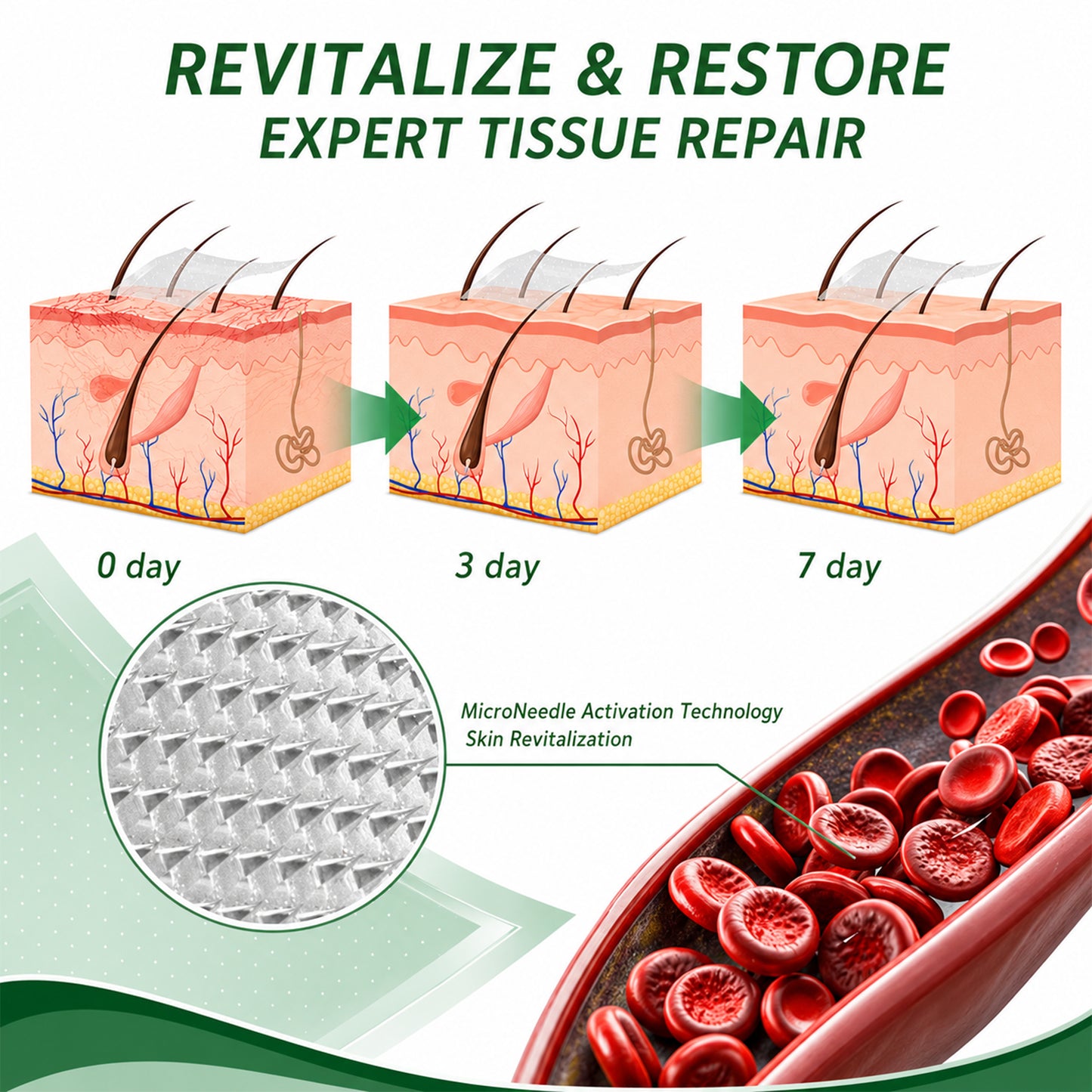 🌿DR.Fachmer® Vein Ease Microneedle Care Patch(For Spider Veins, Varicose Veins, Swelling & Leg Fatigue) - Last Day Promotion 50% OFF