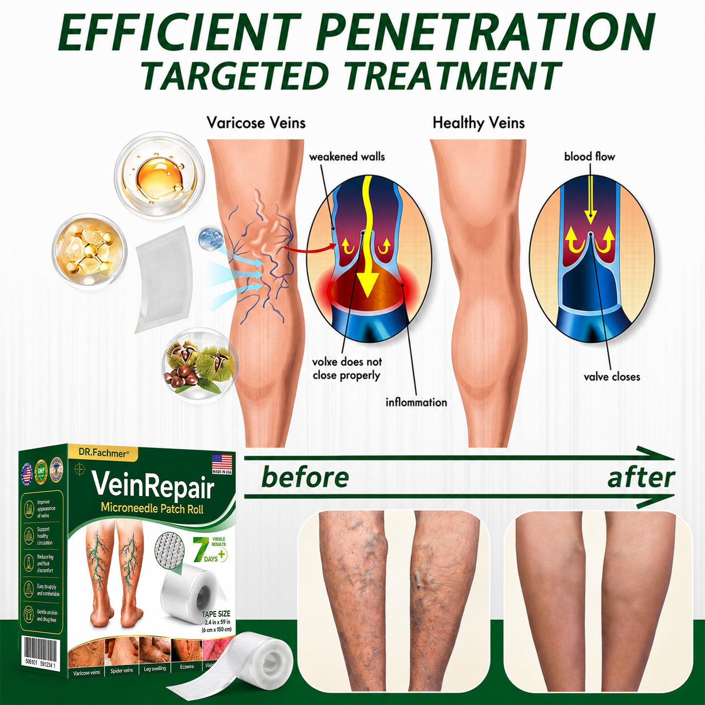 🌿DR.Fachmer® Vein Ease Microneedle Care Patch(For Spider Veins, Varicose Veins, Swelling & Leg Fatigue) - Last Day Promotion 50% OFF