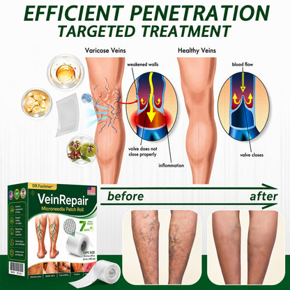 🌿DR.Fachmer® Vein Ease Microneedle Care Patch(For Spider Veins, Varicose Veins, Swelling & Leg Fatigue) - Last Day Promotion 50% OFF