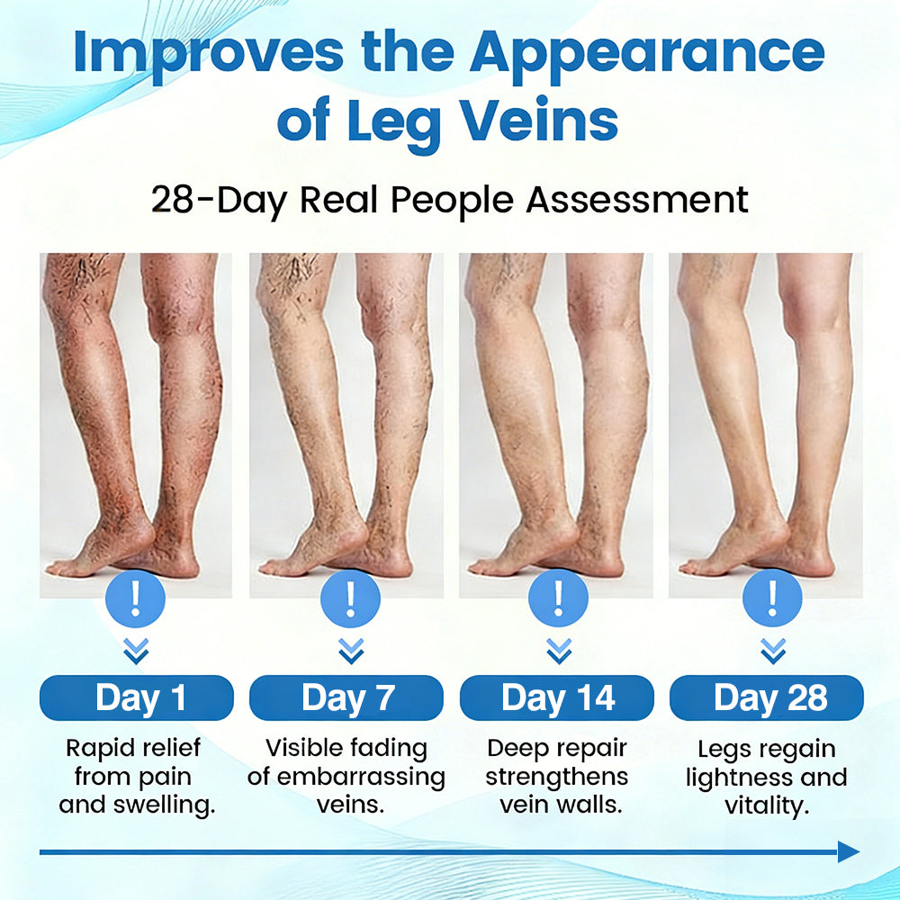 🇺🇸🏆𝗚𝗙𝗢𝗨𝗞® VascuCare Vein Healing Spray(Designed for Varicose veins, Spider veins, Deep vein Thrombosis, Chronic venous insufficiency, Venous ulcers, Thrombophlebitis and other venous issues)