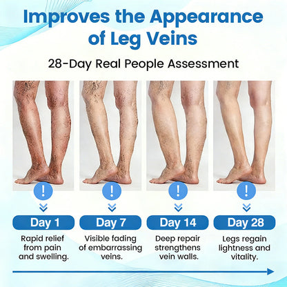 🇺🇸🏆𝗚𝗙𝗢𝗨𝗞® VascuCare Vein Healing Spray(Designed for Varicose veins, Spider veins, Deep vein Thrombosis, Chronic venous insufficiency, Venous ulcers, Thrombophlebitis and other venous issues)