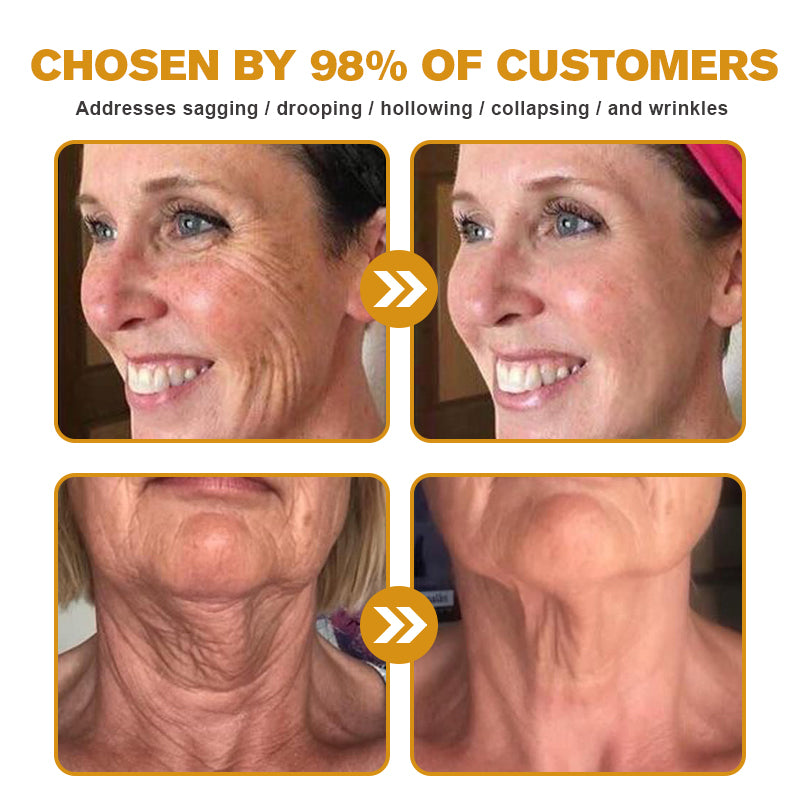 (🇺🇲Made and Shipped from San Francisco) 💥Furzero™ Wrinkle Removal Cream- LAST DAY 70% OFF