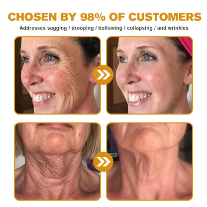 (🇺🇲Made and Shipped from San Francisco) 💥Furzero™ Wrinkle Removal Cream- LAST DAY 70% OFF