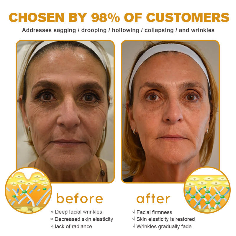 (🇺🇲Made and Shipped from San Francisco) 💥Furzero™ Wrinkle Removal Cream- LAST DAY 70% OFF