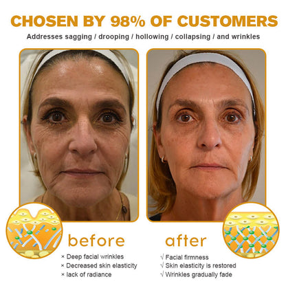 (🇺🇲Made and Shipped from San Francisco) 💥Furzero™ Wrinkle Removal Cream- LAST DAY 70% OFF